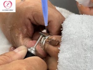 指輪　抜けない　切断　店